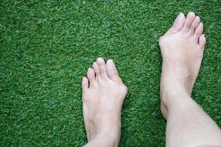 Hallux: causes, symptoms and treatment