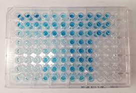 Top 6 Things To Know While Selecting Your Elisa Kits