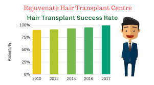 Hair Transplant in Indore: How does it works, success rates?