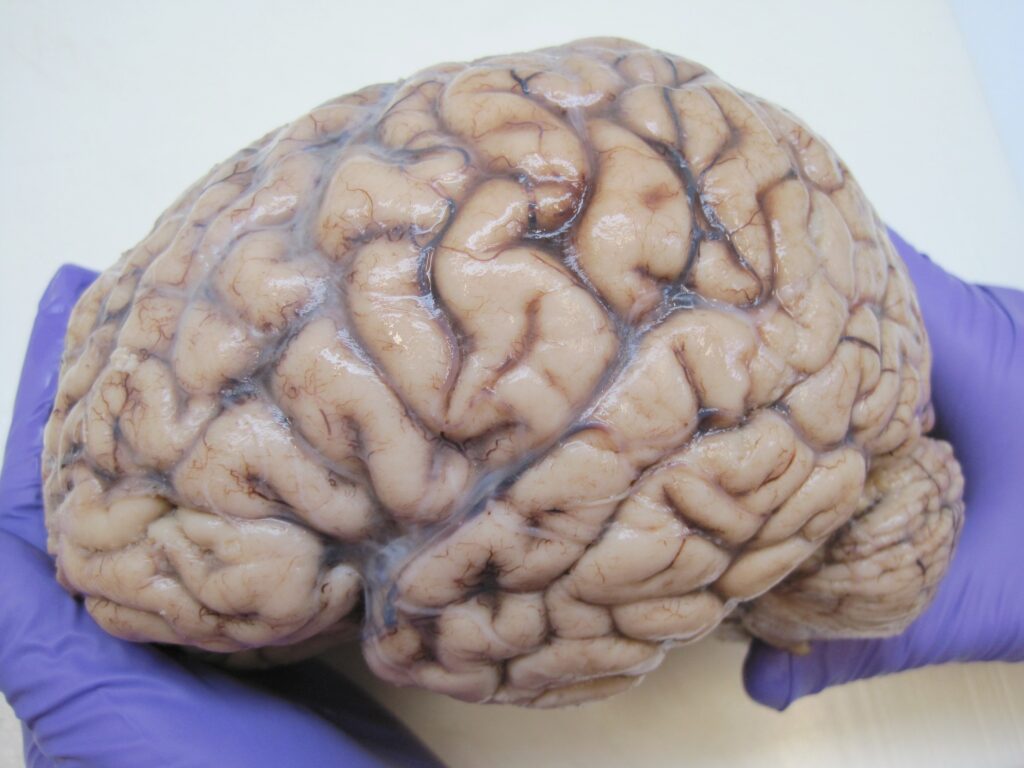 Brain
