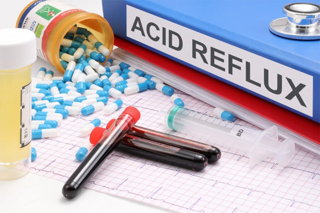 Acid Reflux