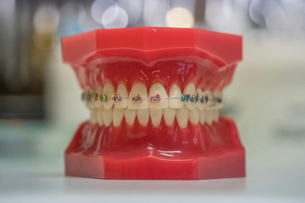 Dental Prosthetics